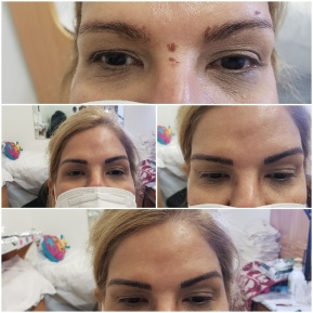 microblading-queens